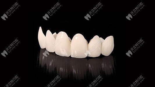 各种牙冠的价格表 各种牙冠的价格表