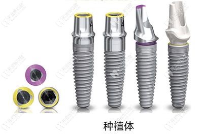 瑞士iti种植体外观 瑞士iti种植体外观