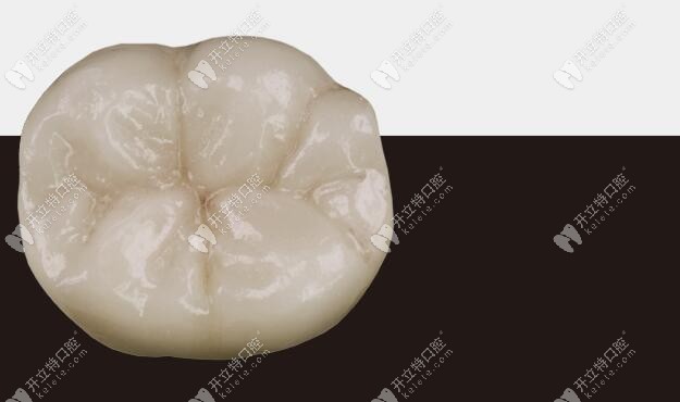后牙—全锆牙齿实图