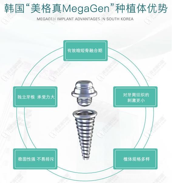 韩国美格真种植体的优势