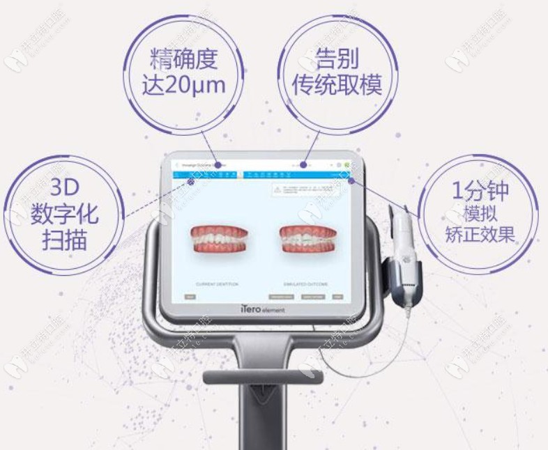 广大口腔iTero口扫设备特点 广大口腔iTero口扫设备特点