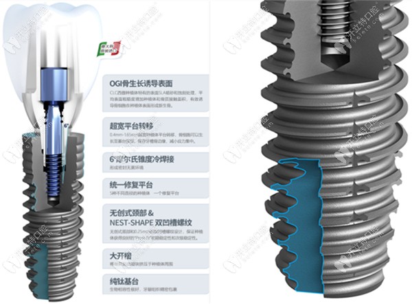 你是想了解意大利西傲clc种植体的价格还是型号呢?这里都有