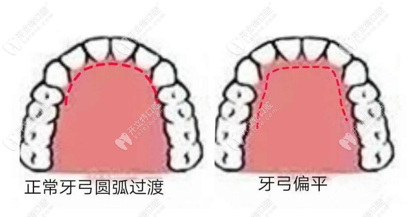 前牙牙弓修复形态