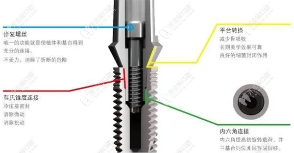 意大利bb种植体与瑞士iti比较，除价格外还有这些区别