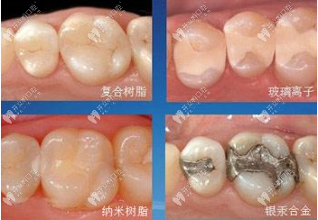 不同树脂材料类型及价格 不同树脂材料类型及价格