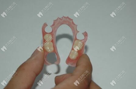 隐形义齿 隐形义齿