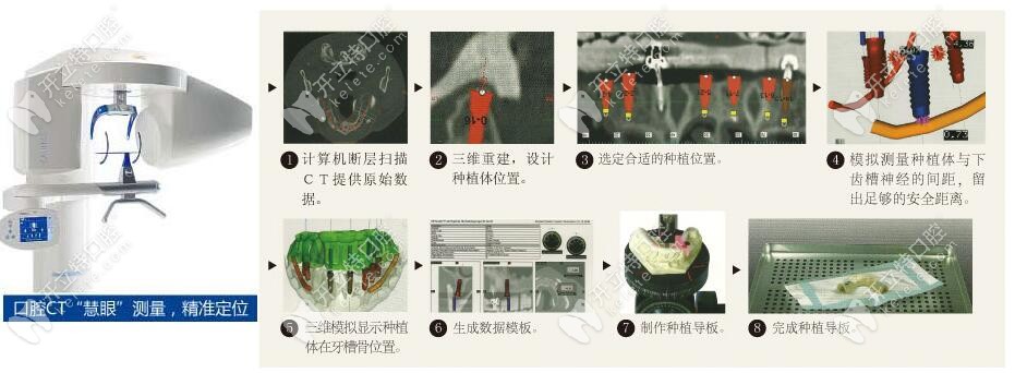 <!--<i data=20240703-sp></i>-->口腔种植牙技术
